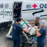 Lima a paciente de 13 años con fractura de maxilar inferior