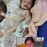 Bebe que sufrió quemaduras necesita apoyo urgente