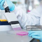 Chota registra 50 casos de VIH y cifra sigue en aumento, el paciente más joven es de 18 años